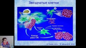 Дворец Снежной королевы (фиброз поджелудочной железы)