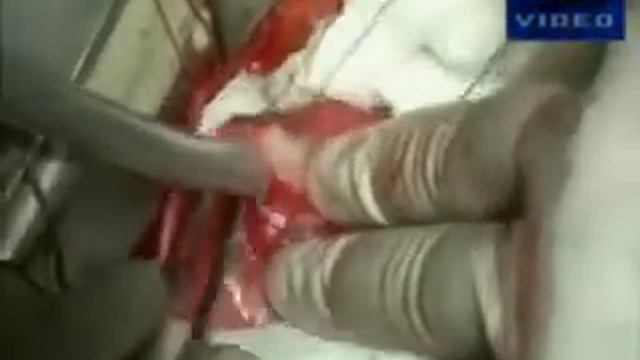 Фитокомплекси компании CHOICE смотреть онлайн