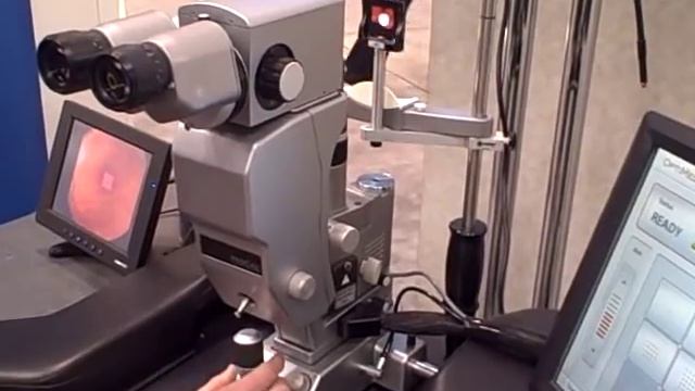 PASCAL (pattern scan laser) photocoagulator from Optimedica: A Customer Application смотреть онлайн