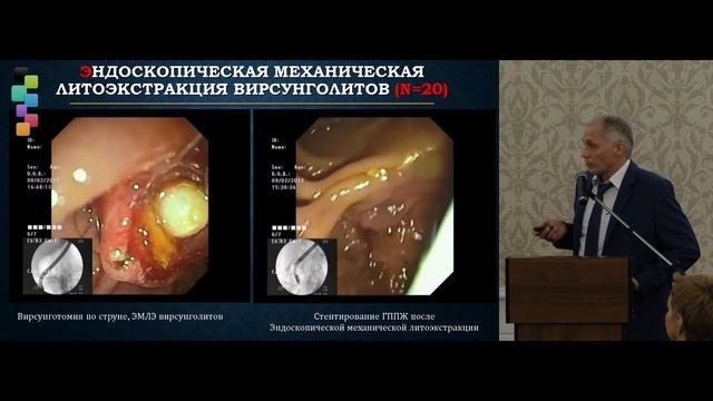 26. Основные принципы эндоскопической ретроградной литоэкстракции смотреть онлайн