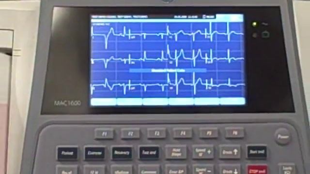 Cardiology Shop MAC 1600 EKG Machine смотреть онлайн