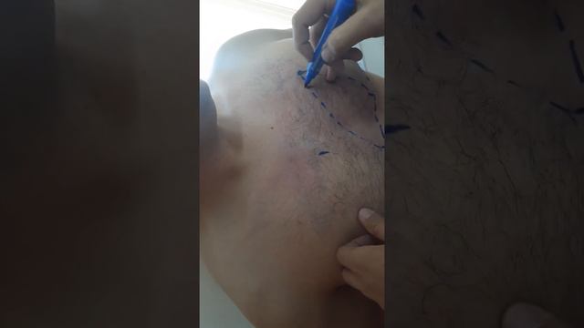 Ikp, Yurak Perkussiyasi,yurak Nisbiy Va Mutloq Chegarasi,tomir Tutami