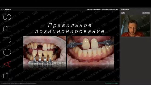 Артём Олексик - грамотная коммуникация с зуботехнической лабораторией. смотреть онлайн