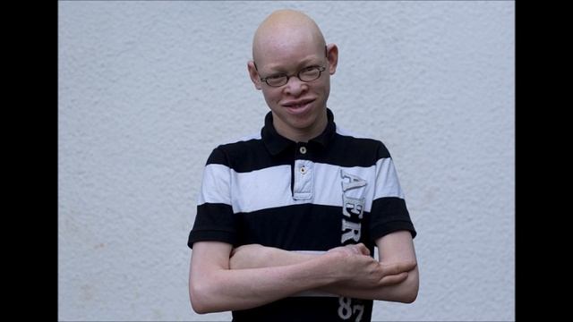Тела этих людей в Танзании стоят дороже золота. На них ведется вечная охота! смотреть онлайн