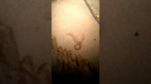 Как выглядит трихинелла?