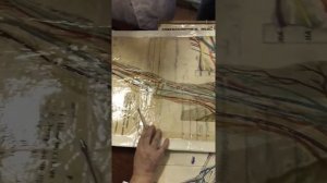 Вены верхней конечности