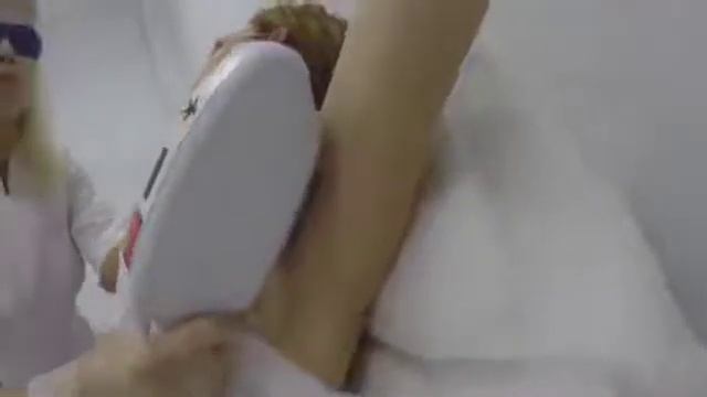 La Depilación Láser