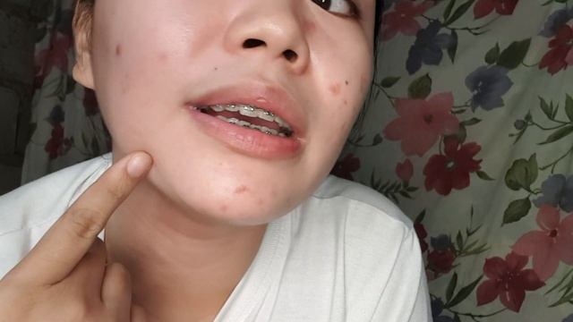 Brilliant skin rejuvenating set | HONEST REVIEW!! | 1 MONTH RESULT смотреть онлайн