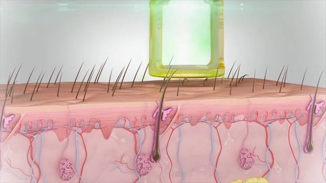 GentleLase Pro - Inovação em conforto e segurança para depilação! смотреть онлайн