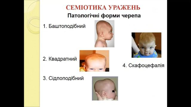 АФО кісткової системи смотреть онлайн