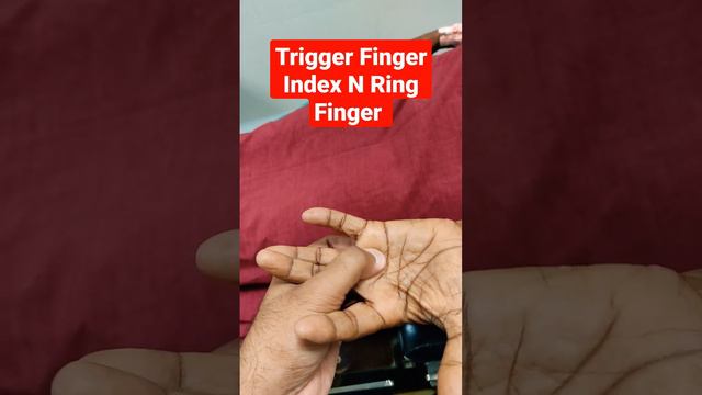Trigger Finger Index N Ring Finger ..Dr Sai Chandra MBBS DNB Ortho смотреть онлайн