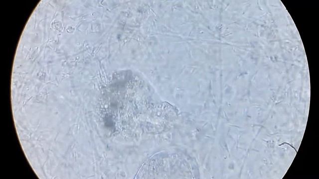 Микроорганизмы в скоплении бактерий. 1000х \\\ Microorganisms in the accumulation of bacteria. 1000 смотреть онлайн