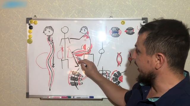 Кифоз, Сколиоз, Лордоз простыми словами и как это можно исправить? смотреть онлайн