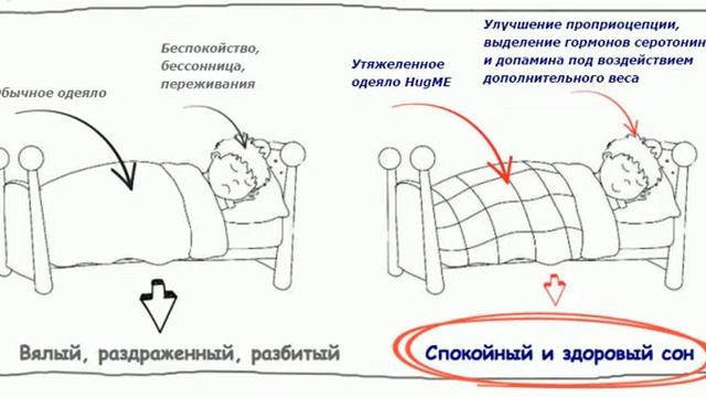 Зачем нужны утяжеленные одеяла смотреть онлайн