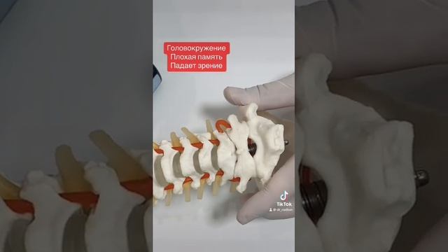 Головокружение, падает зрение и плохая память от позвоночной артерии