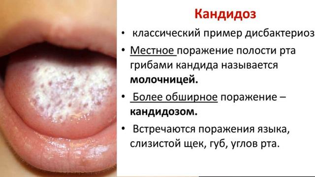 ИМБИРЬ - Польза и Вред (Самая популярная пряность, содержащая в себе множество свойств)