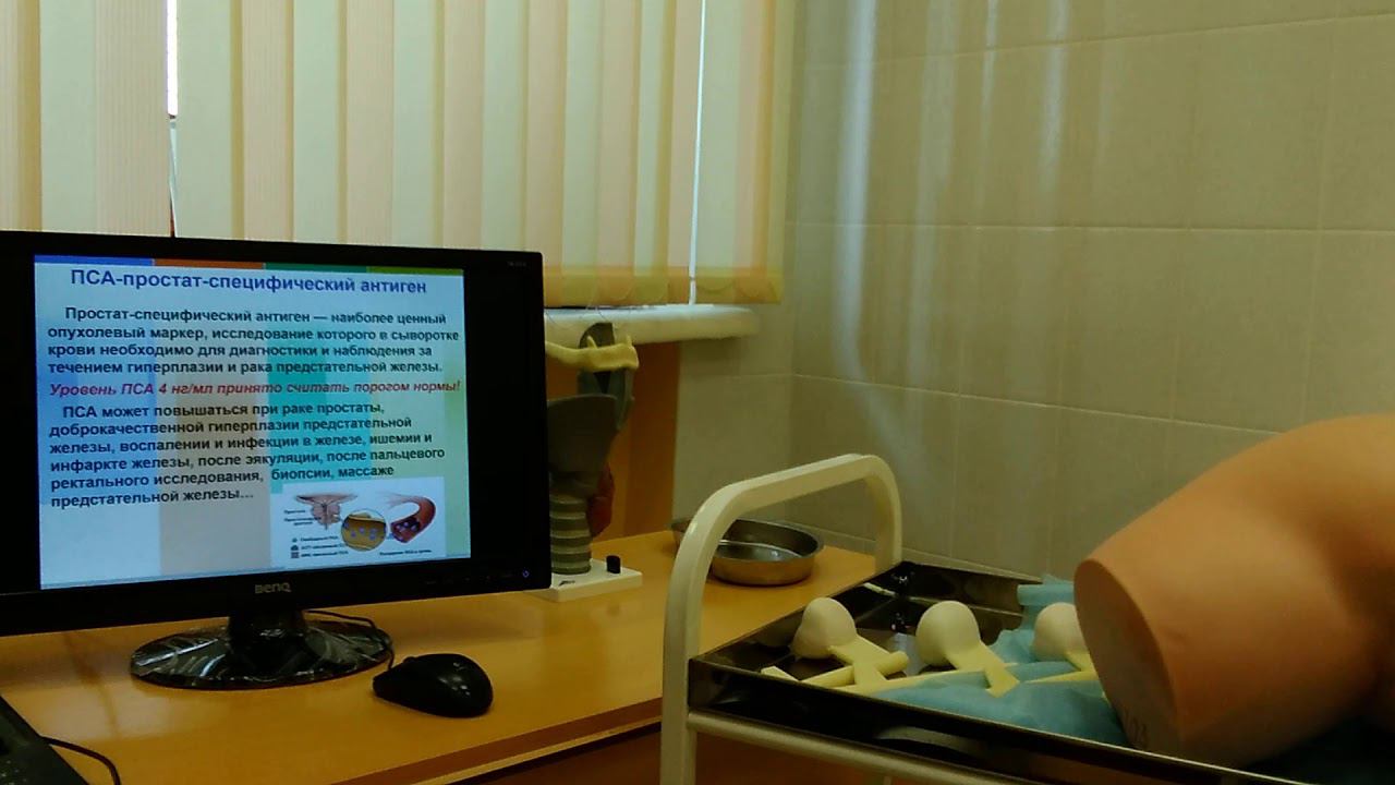 Доброкачественные и злокачественные опухоли предстательной железы смотреть онлайн