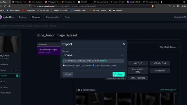 Roboflow Dataset How to use for Yolo| Yolov8| Tutorial |Google Colab Train смотреть онлайн