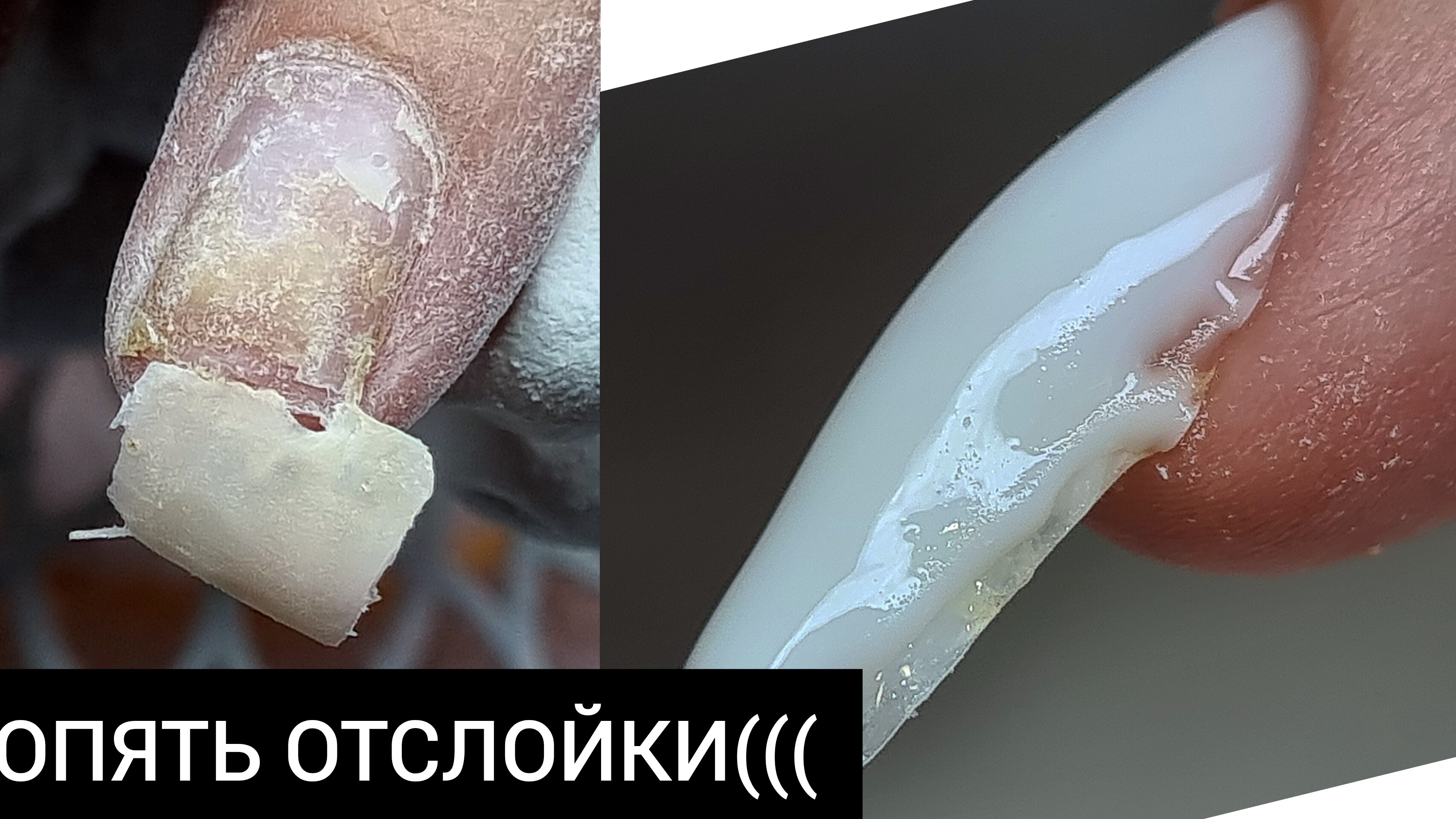 ПОЧЕМУ у меня ВСЕГДА ОТСЛОЙКИ