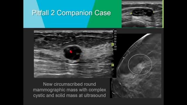 Breast Ultrasound Workshop Pitfalls Ultrasound Video Lecture смотреть онлайн