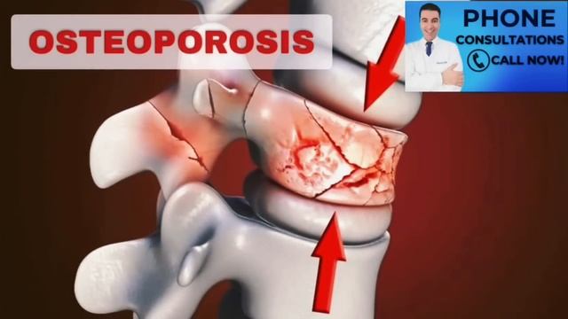Kako spriječiti KRVNE UGRUŠKE i VISOKI KOLESTEROL prirodnim putem ? смотреть онлайн