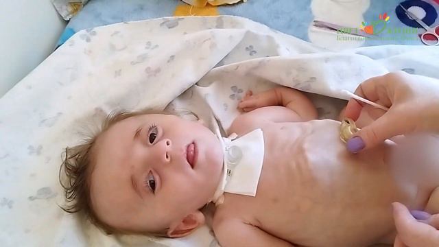 19. Несовершенный остеогенез. Как обрабатывать область вокруг гастростомы смотреть онлайн