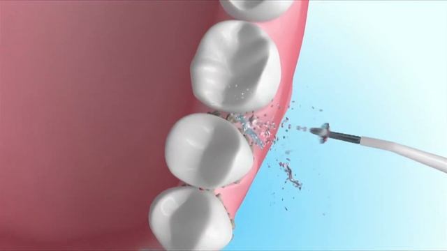 AQUAPICK 3D AQ-300_ENG смотреть онлайн