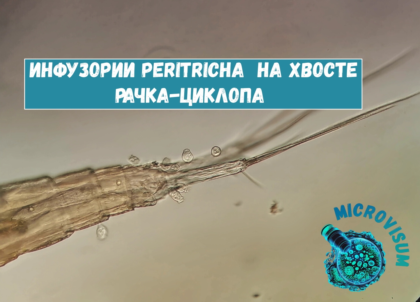 Инфузории Peritricha на хвосте рачка-циклопа смотреть онлайн