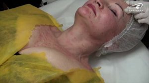 Как понять, что работаешь в дерме?