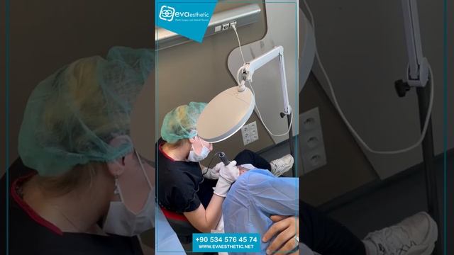 Stages of the hair transplant process in Turkey | Eva Esthetic смотреть онлайн