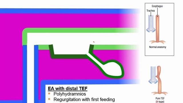 GIT embryology first aid usmle смотреть онлайн