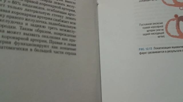 Инфаркт миокард по книге Котранж