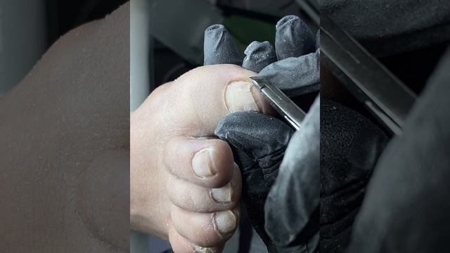 педикюр | этапы обработки #педикюр #обработканогтей #ногти