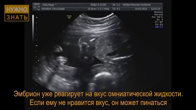 22 неделя беременности. Развитие плода. Что чувствует беременная. Как выглядит ребенок на 22 неделе смотреть онлайн
