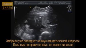 22 неделя беременности. Развитие плода. Что чувствует беременная. Как выглядит ребенок на 22 неделе