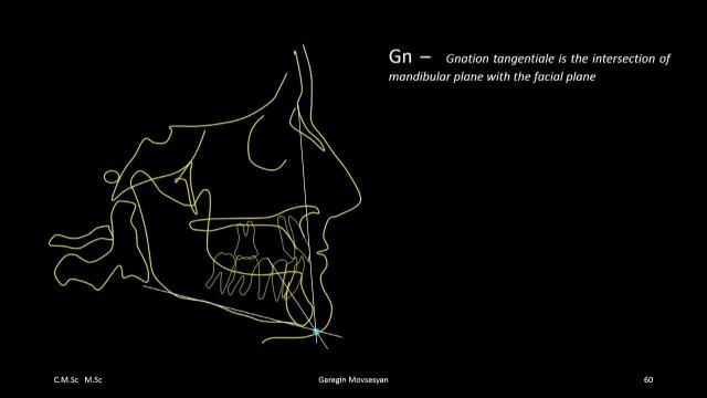 Точки Gn and Go на ТРГ. Рад, что полезен. Др. Гарегин Мовсесян смотреть онлайн