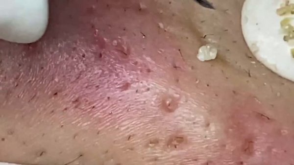 Enjoy Every Day With The Best Video Loan Nguyen Spa Official 1585