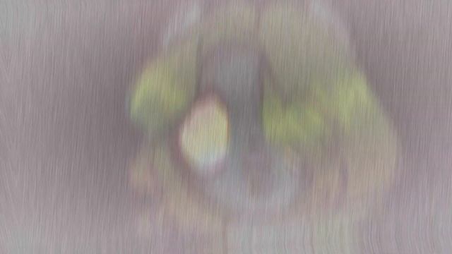 // ПОНИ КЛИП // -- МОЯ ГОЛОВА ВИНТОМ | смотреть онлайн