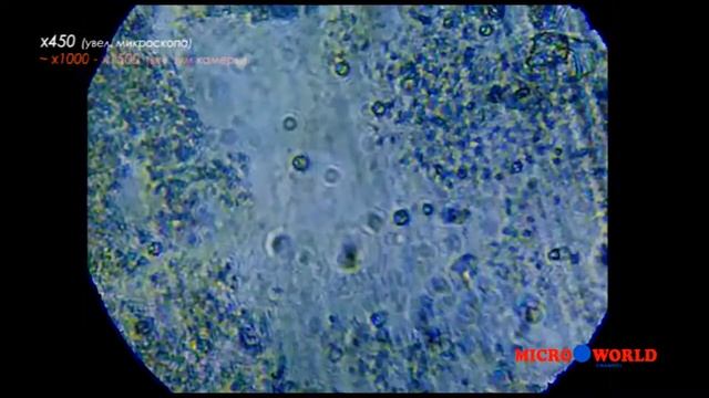 МИКРОБЫ В ТАЗИКЕ ДЛЯ СТИРКИ - MICRO WORLD #6 смотреть онлайн