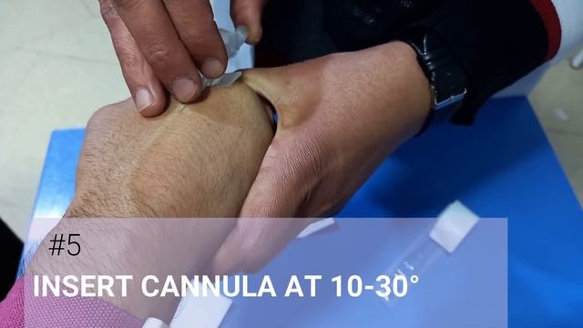 Intravenous (IV) Cannulation Guide смотреть онлайн