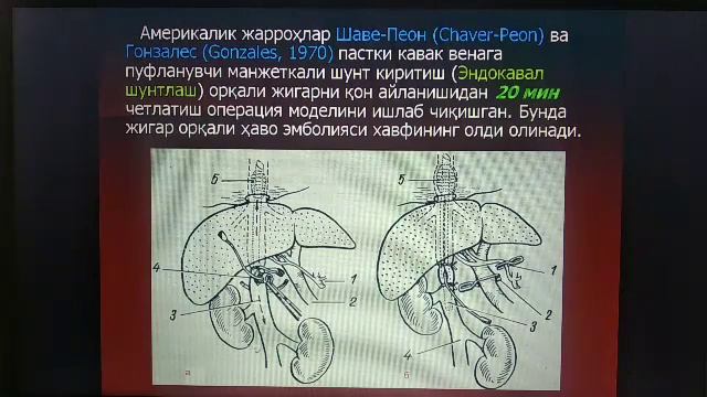 Jigar Va Jigar Biliar Tizimining Jarrohlik Anatomiyasi Va Operatsiyalar. Oshqozon Osti Bezi Va Talo