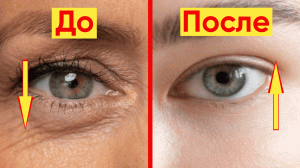 КАК ПОДНЯТЬ НАВИСШЕЕ ВЕКО И РАЗГЛАДИТЬ МОРЩИНЫ ВОКРУГ ГЛАЗ!