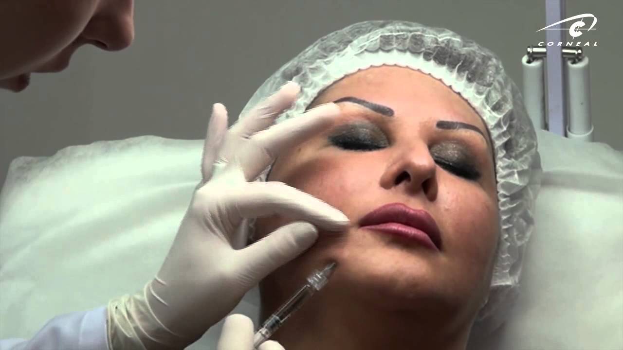 Контурная пластика - сепарация смотреть онлайн