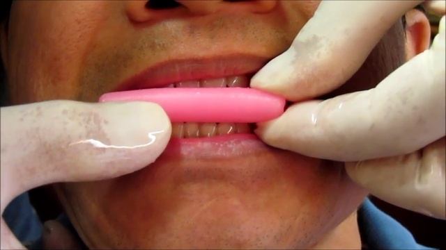 Bite Registration With Larry Swisher