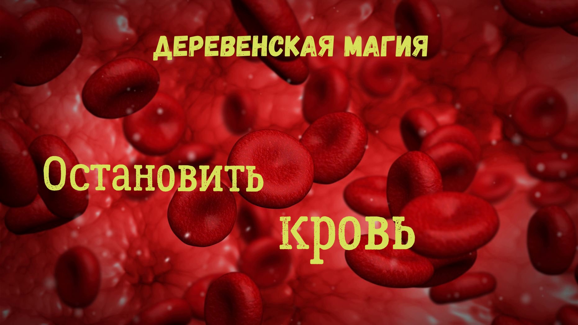 Остановить кровотечение. смотреть онлайн