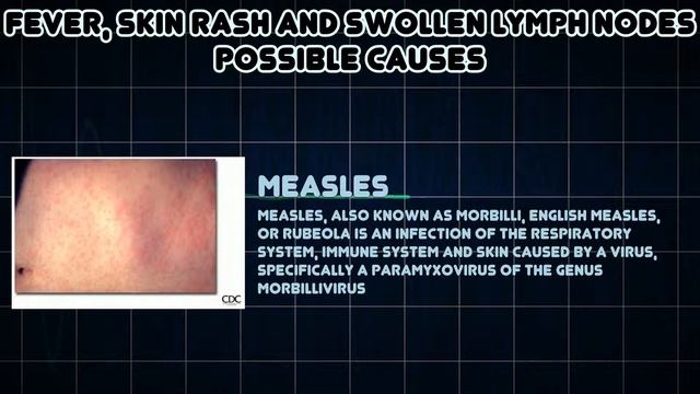 Fever, Skin rash and Swollen lymph nodes (Medical Symptom) смотреть онлайн