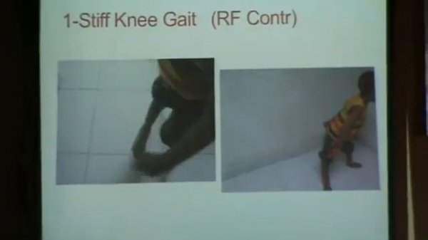 classification of CP