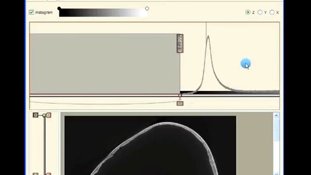 Import DICOM as Raw slices смотреть онлайн