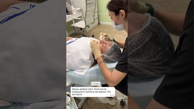 Пилинг летом смотреть онлайн