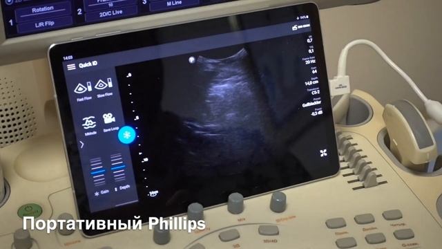 Обзор портативного узи аппарата Philips Lumify смотреть онлайн